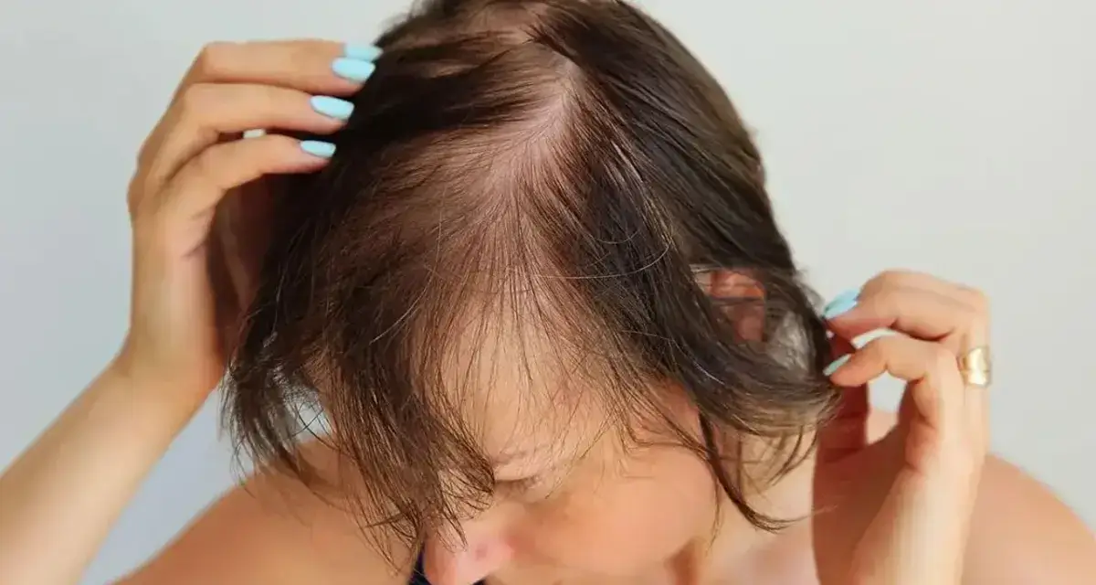 why does ozempic cause hair loss